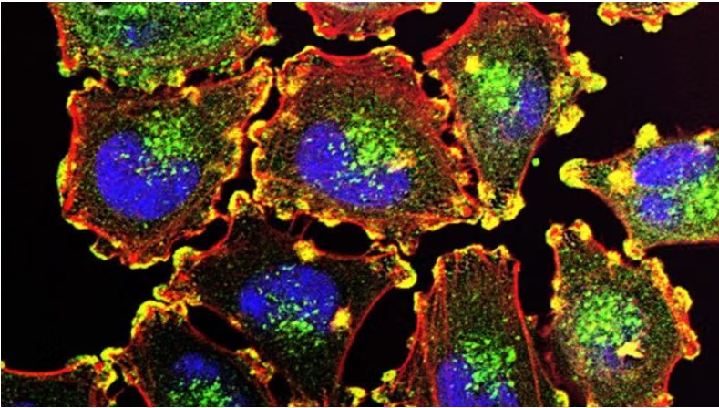 Indian scientists develop AI tool to detect hidden cancer cells